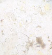 Wurmbefall unter einem Mikroskop